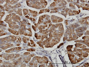 Carboxypeptidase B