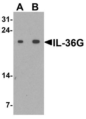 Interleukin-36 gamma Antibodies | AntibodyResource.com